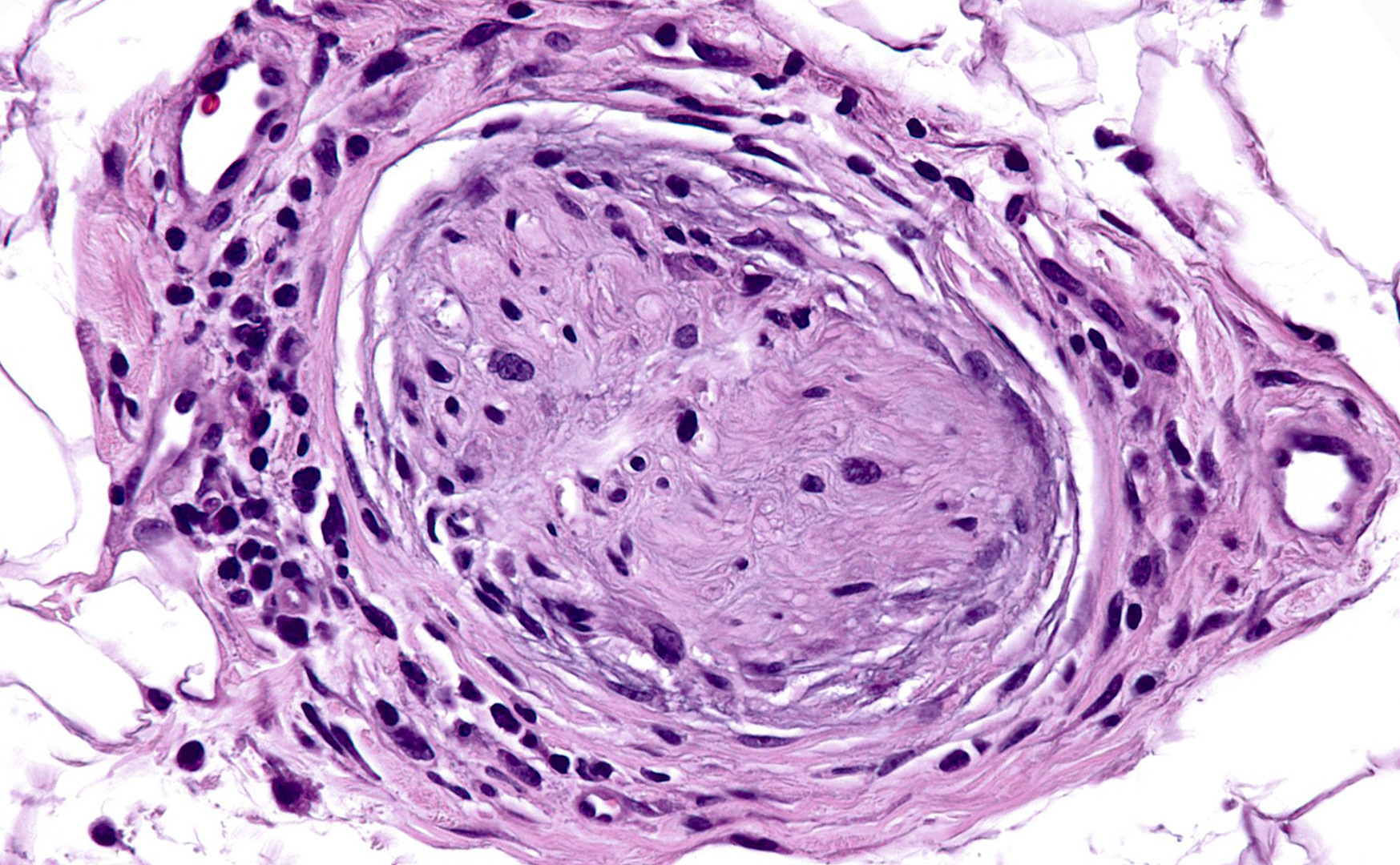 Murphy Skin Biology Research Dermatopathology Laboratory at BWH and