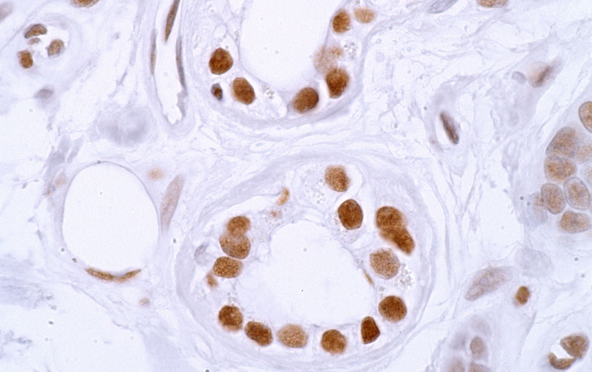 Murphy Skin Biology Research Dermatopathology Laboratory at BWH and